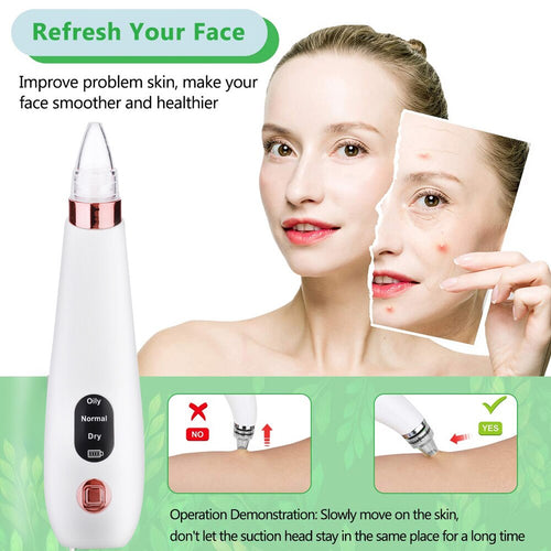 Clear Beauty Remove Blackhead Blackhead Removal Equipment ABS White Black Head Cleaner Cosmetic Instrument Fashion Effective