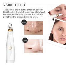 Load image into Gallery viewer, Clean Black Head Cleaner Effective ABS Remove Fast Blackhead Removal Equipment Cosmetic Instrument White Facial Beauty